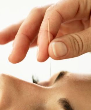acupuncture for eyes