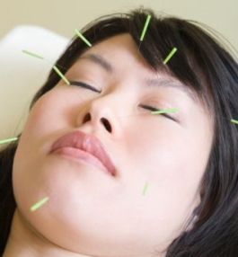 how does acupuncture work
