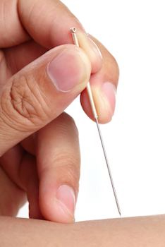 Life Threatening Sepsis Can Be Cured with Acupuncture Treatment