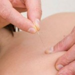 acupuncture and copd