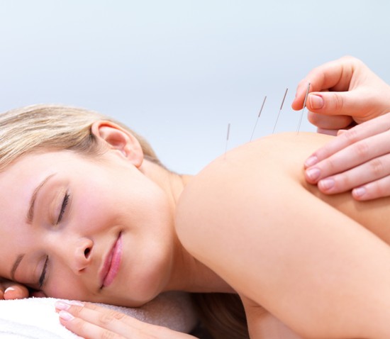 acupuncture vs. dry needling