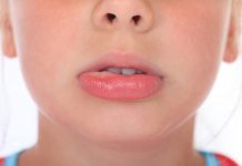 Home Remedies For Swollen Lips