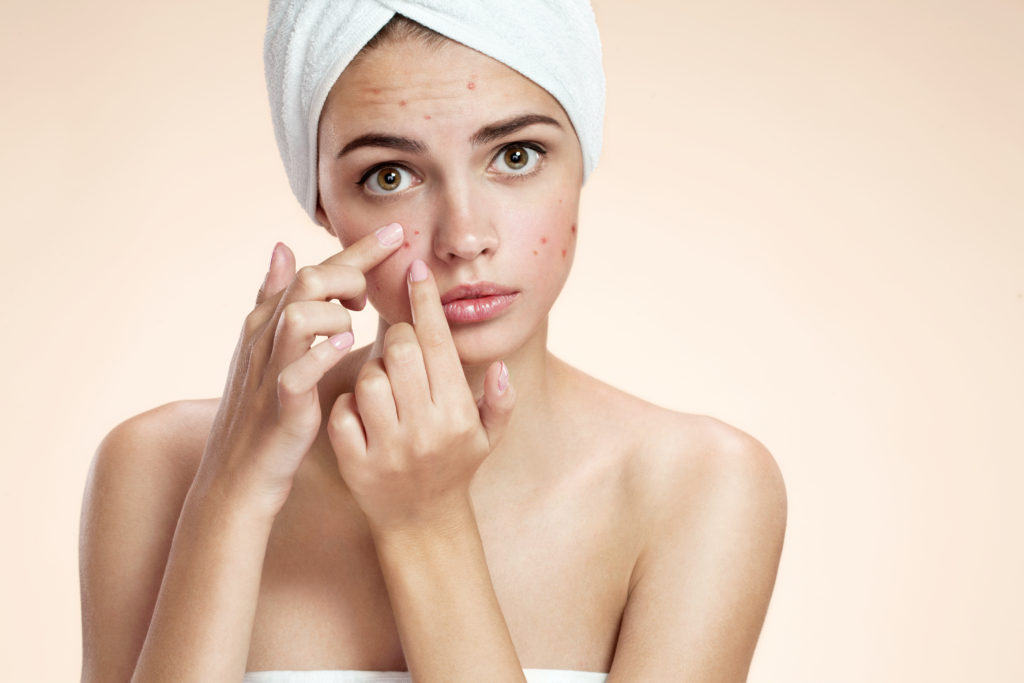Ayurvedic Diet Tips That Help You Prevent Hormonal Acne