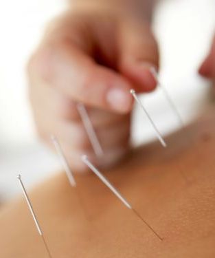 acupuncture for asthma