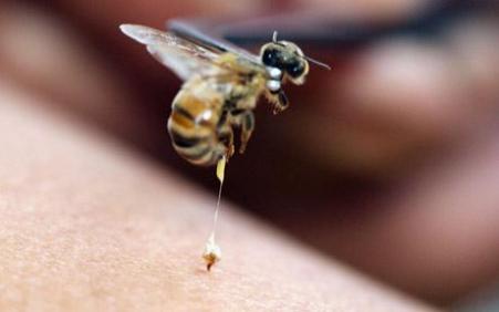 Bee Venom to Treat Rheumatoid Arthritis