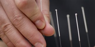 Acupressure vs. Acupuncture - Things You Must Know