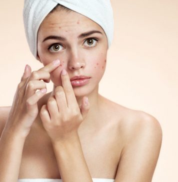 Ayurvedic Diet Tips That Help You Prevent Hormonal Acne